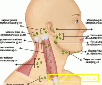 Die Lage der Lymphknoten am Hals: das Schema